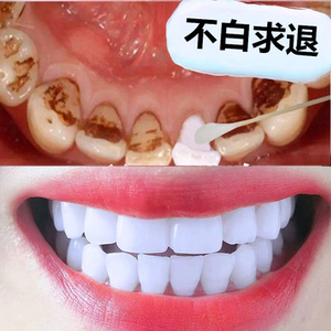 梵诗迪牙粉牙齿洗牙粉美白神器亮白去黄速效洗白亮白牙斑净去牙结