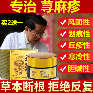 治疗慢性寻荨麻疹断根外用药风团过敏皮肤瘙痒止痒进口专用中药膏