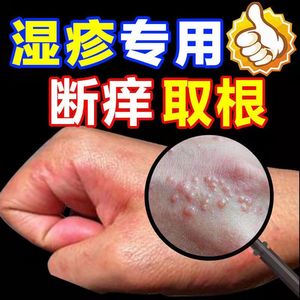 神龙百草止痒膏外用脂溢性皮炎湿疹止痒去根止痒神器抑菌专用药膏