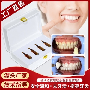 现货正品原牙色素提取牙齿美白凝胶套装 过氧化氢牙齿护理美牙剂