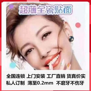 义获嘉全瓷贴面 冰瓷美牙贴片牙齿美白贴面水晶瓷 铸瓷 玻璃陶瓷