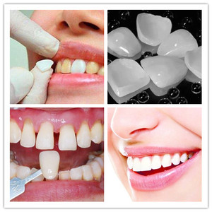 美白牙贴片超薄全瓷贴面冰瓷德国维他牙齿美白水晶琥珀陶瓷义获嘉