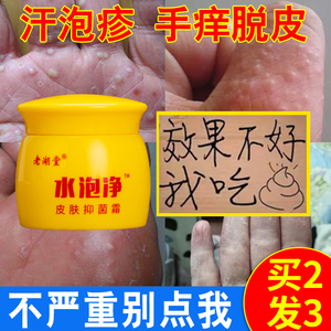 汗疱疹药膏汗孢疹克星汗泡疹膏汗状皰疹季节性手上起小水泡脱皮净