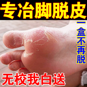 脚底脱皮专用药脚皮肤干燥掉皮脱皮干裂抑菌止痒膏【手足脱皮霜】