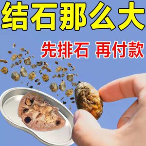 肾结石专用药排石茶中草药金钱草贴克星震动器神器碎石机治疗的