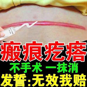 膏去除多年手术缝针疤痕灵祛淡化痘印痘疤套装祛疤消印美容馆266