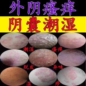 治疗阴囊潮湿专用药女男士私处瘙痒脱皮去潮湿异味外阴瘙痒止痒膏