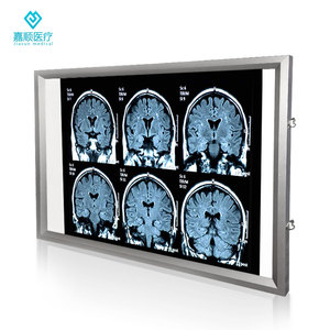 医用观片灯led观片灯箱智能x光单联双联ct超薄遥控骨科口腔科阅片