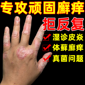 百草膏止痒膏皮肤抑菌老专家草本抑菌乳膏百毒膏苗家正品皮肤痒