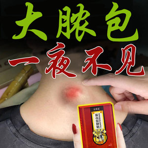 00刘文_2012淘宝冶疖子药神器多发性纤维粉瘤克星专攻脂肪瘤拔毒膏