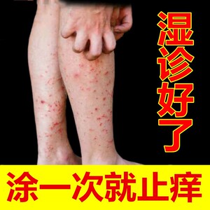 苗方百草膏湿疹止痒去根去痒皮肤瘙痒湿痒抑菌干燥治身上痒过敏药
