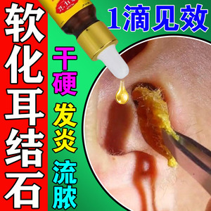 耳结石软化水滴耳液治疗耳朵痒止痒抑菌取耳屎耳耵聍油清洁剂神器