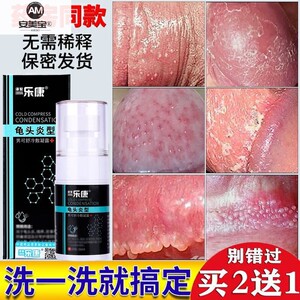 包皮龟头炎男性私处清洁洗液瘙痒白红点异味护理液阴茎囊喷剂19jy