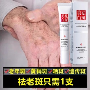 祛斑霜正品祛斑手上脸部手背老年斑除老人斑美白专用老年黑班斑部