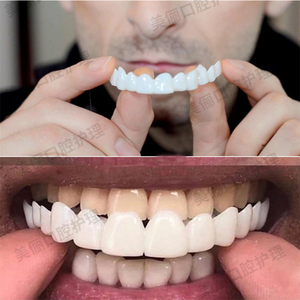 假牙套牙仿真美白牙套吃饭神器临时假牙贴片仿真牙齿硅胶镀膜龅牙