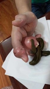 水蛭活体蚂蝗活体医用 吸血疗法养殖入药 金边蚂蝗活力好