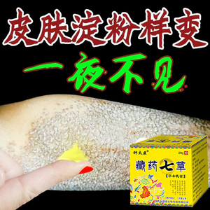 皮肤淀粉样变专用药【101%痊愈】顽固反复性苔藓斑状淀粉止瘙痒膏