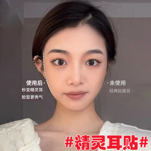 精灵耳贴神器招风耳立耳贴固定贴定型改善贴面耳隐形硅胶