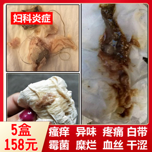 女人下面豆腐渣凝胶图片