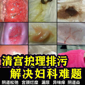 用洗阴器洗出豆腐渣图片