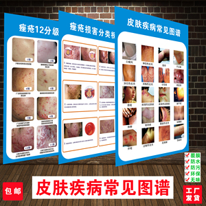 皮肤病墙贴纸皮肤疾病常见图谱医院皮肤科挂图宣传海报装饰画