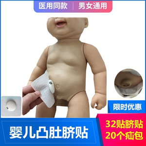 宝宝气肚脐
