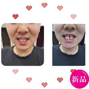 牙齿套单颗牙套临时补缺牙自补假牙遮盖临时牙牙套树脂牙贴片门牙