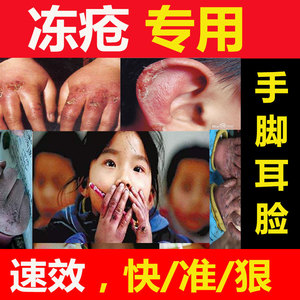 冻疮膏手部手足