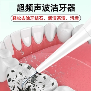 超声波洁牙器牙结石牙垢去除器牙齿美白洗牙神器家用美牙仪口腔镜