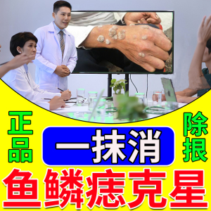 鱼鳞痣药膏去除刺猴肉疣疙瘩正品药贴祛手足部瘊子肉刺鸡眼神器
