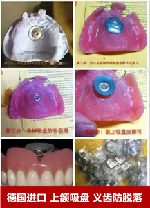德国helo上颚吸盘皮上颌全口义齿活动假牙胶橡胶吸皮吸盤牙科包邮