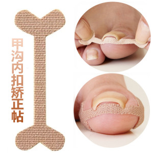 脚趾甲弯曲内嵌甲矫正器甲沟指甲长肉里卷甲拉拉贴正甲贴0人付款178