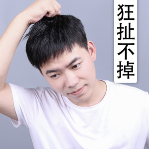 男士假发全头套顶前额秃顶补发垫贴接发际线短刘海翻盖真帅气整顶