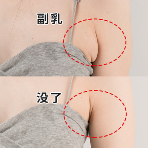 【小红书爆火 去副乳神器】收副乳消除帖 淋巴解散结 去腋下结节