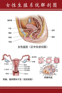 女性盆腔卵巢子宫示意图医学宣传挂图人体器官解剖图医院布置海报
