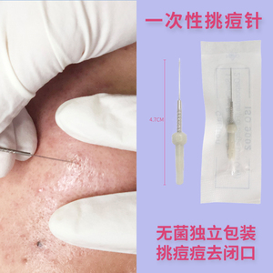 祛痘针清工具一次性清痘针挤痘痘针小美容针粉刺针超细尖挑痘排痘