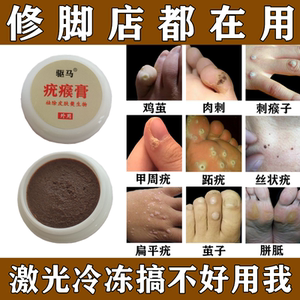 跖疣专用鸡眼药膏去除手部刺瘊子足部脚底血胞刺肉刺根寻常疣神器