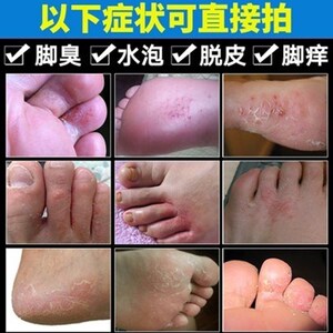 皮肤抗菌液美浮特