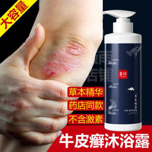 皮肤病牛皮癣银屑病专用药浴湿疹荨麻疹瘙痒止痒去癣中草药沐浴露