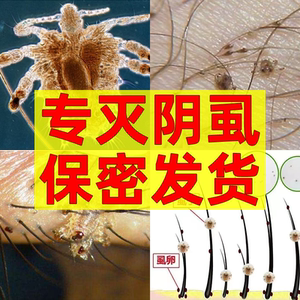 阴虱药男女私处药去虱子神器下面阴毛瘙痒长虫子体虱卵一扫光喷剂