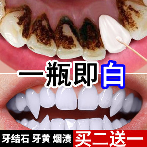 牙齿清洁神器溶解结石去除牙垢洗牙器家用速效清除牙石工具牙菌斑