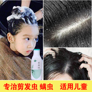 去卷发虫专业除螨去螨虫儿童剪发虫洗发水6 12岁女孩止痒去屑神器