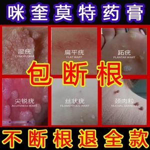 寻常疣专用药手部咪奎莫特药膏乳膏疣米奎咪喹丝状疣去疣么特脱疣