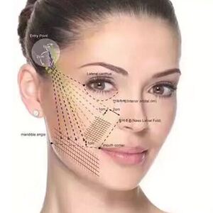 线雕蛋白线脸部