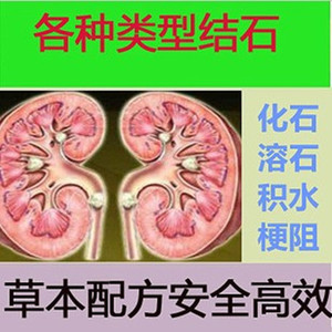 结石草药偏方肾输尿管等结石化石溶石去积水中草药消石茶中药材