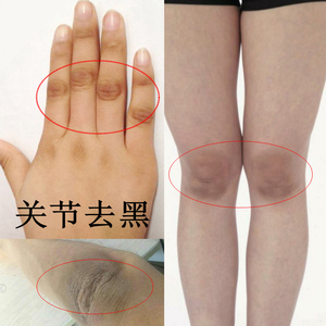 手指关节去黑神器膝盖手肘脚踝胳膊肘去黑色素腋下黑变白按摩膏