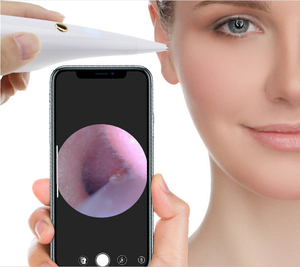 医用wifi可视耳鼻喉内窥镜宠物检耳镜儿童掏耳勺可视耳镜诊所口腔