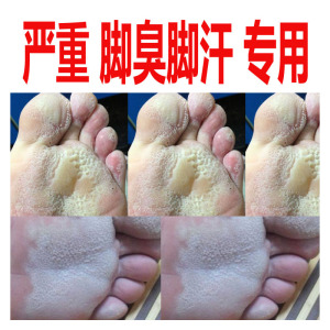 脚部止汗露足部护理液香体露去手汗净爽止汗剂喷雾男女士10人付款29