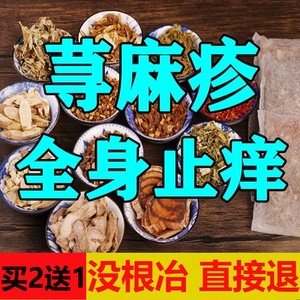 荨麻疹过敏止痒断根专用药膏急慢性治疗皮肤瘙痒寻荨麻疹克星药膏