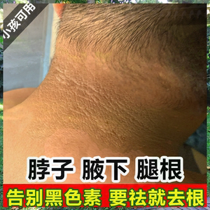 洗黑脖子神器去黑棘皮上的黑色素后面黑怎么办太阳晒黑修复变白女